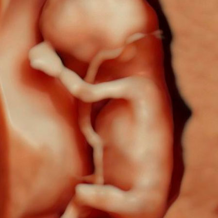 bebe