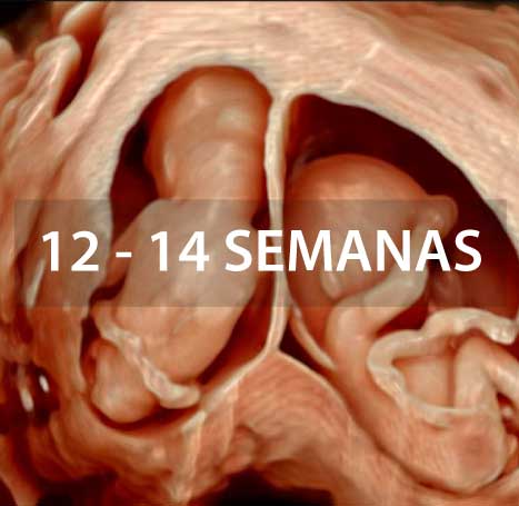 ecografia-gemelar-instituto-peruano-de-medicina-y-cirugia-fetal