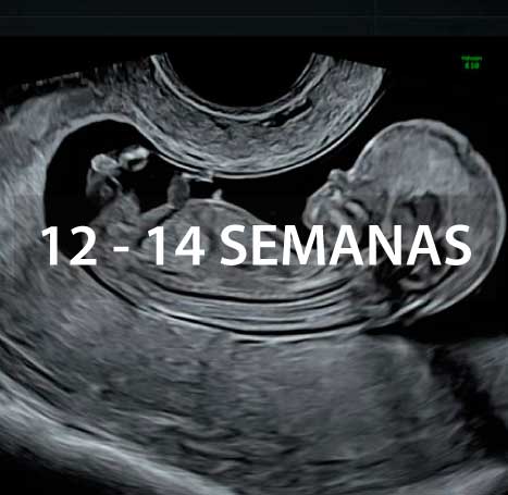 ecografia-genetica-instituto-peruano-de-medicina-y-cirugia-fetal