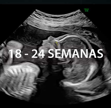 ecografia-morfologica-instituto-peruano-de-medicina-y-cirugia-fetal