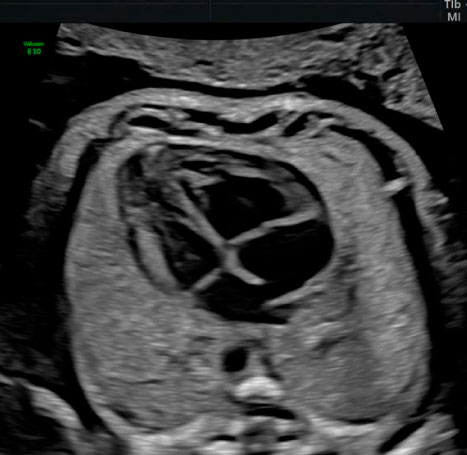 ecocardiografia-instituto-peruano-de-medicina-y-cirugia-fetal-2